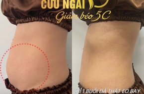  CỨU NGẢI GIẢM BÉO - ĐẸP KHÔNG GIỚI HẠN!