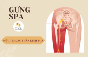 NHỮNG AI DỄ BỊ ĐAU THẦN KINH TỌA?